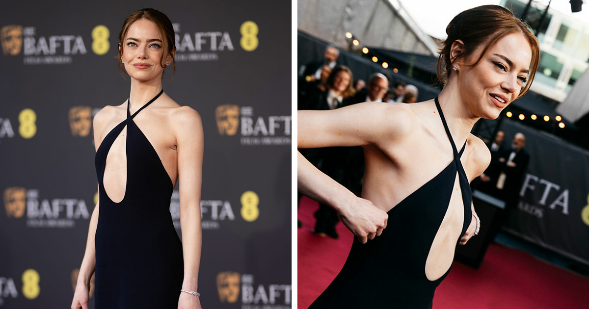 “She Looks Cadaverous”: Emma Stone’s Appearance At The 2026 BAFTAs Sparks Major Concerns