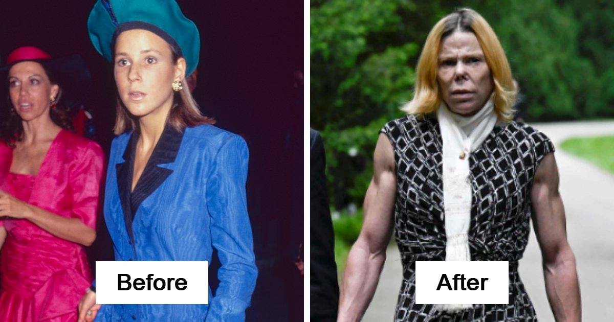 17 Stars Whose Dramatic Transformations Had Everyone Talking This Year