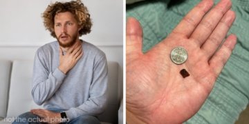 “Chasing Diagnoses For 35 Years—And The Answer Was In My Dinner”