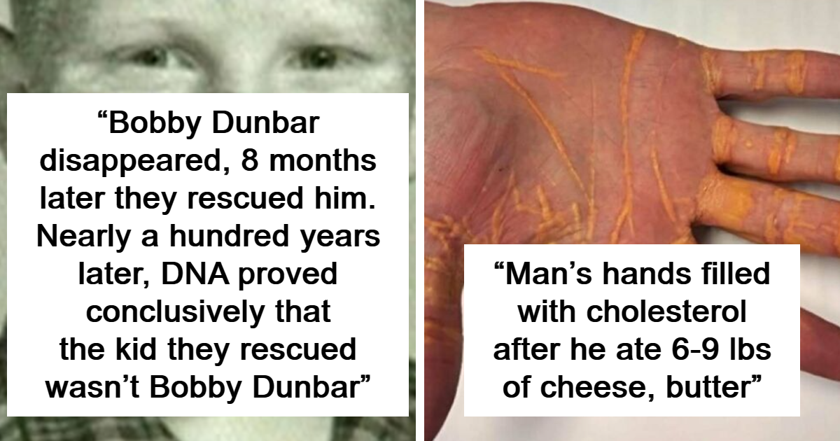 “Oddly Horrifying”: 28 Of The Most Unnerving Images That Might Freak You Out