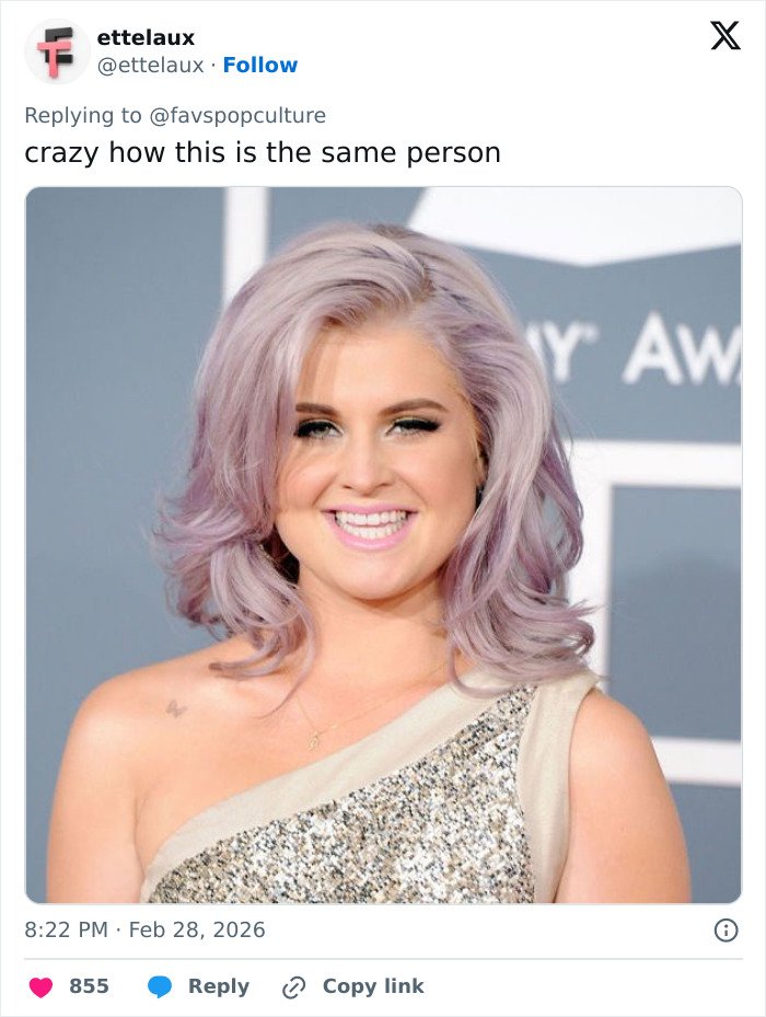 Kelly Osbourne posing at an awards event, sparking fans' speculation about buccal fat removal changes.