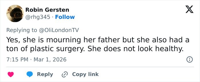 Tweet criticizing Kelly Osbourne&rsquo;s health and plastic surgery in response to Brit Awards look going viral.