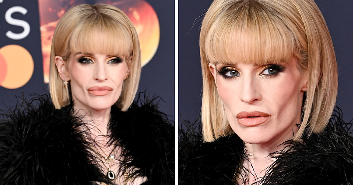 Fans Accuse Kelly Osbourne Of Buccal Fat Removal As Her Brit Awards Look Goes Viral